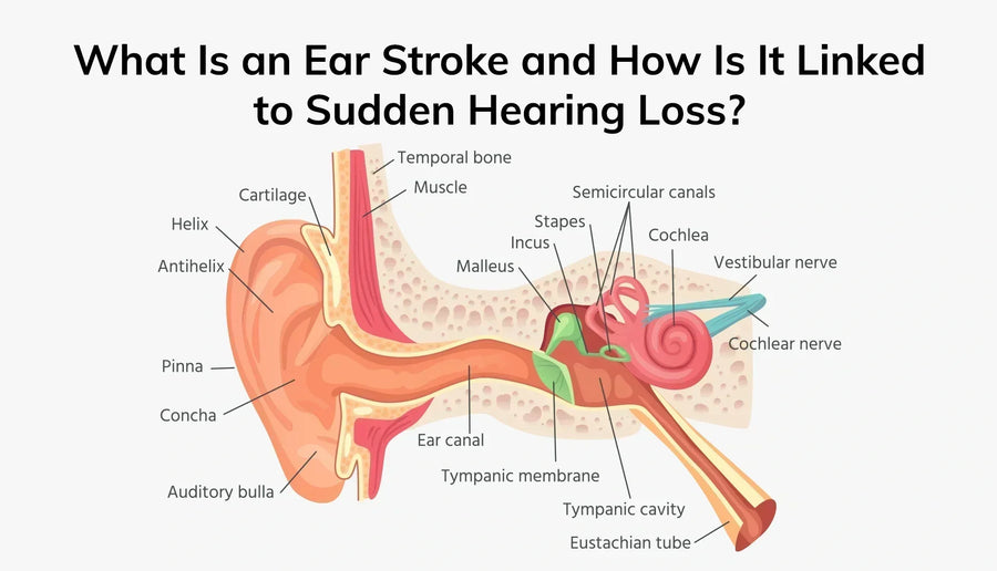 What Is an Ear Stroke and How Is It Linked to Sudden Hearing Loss?