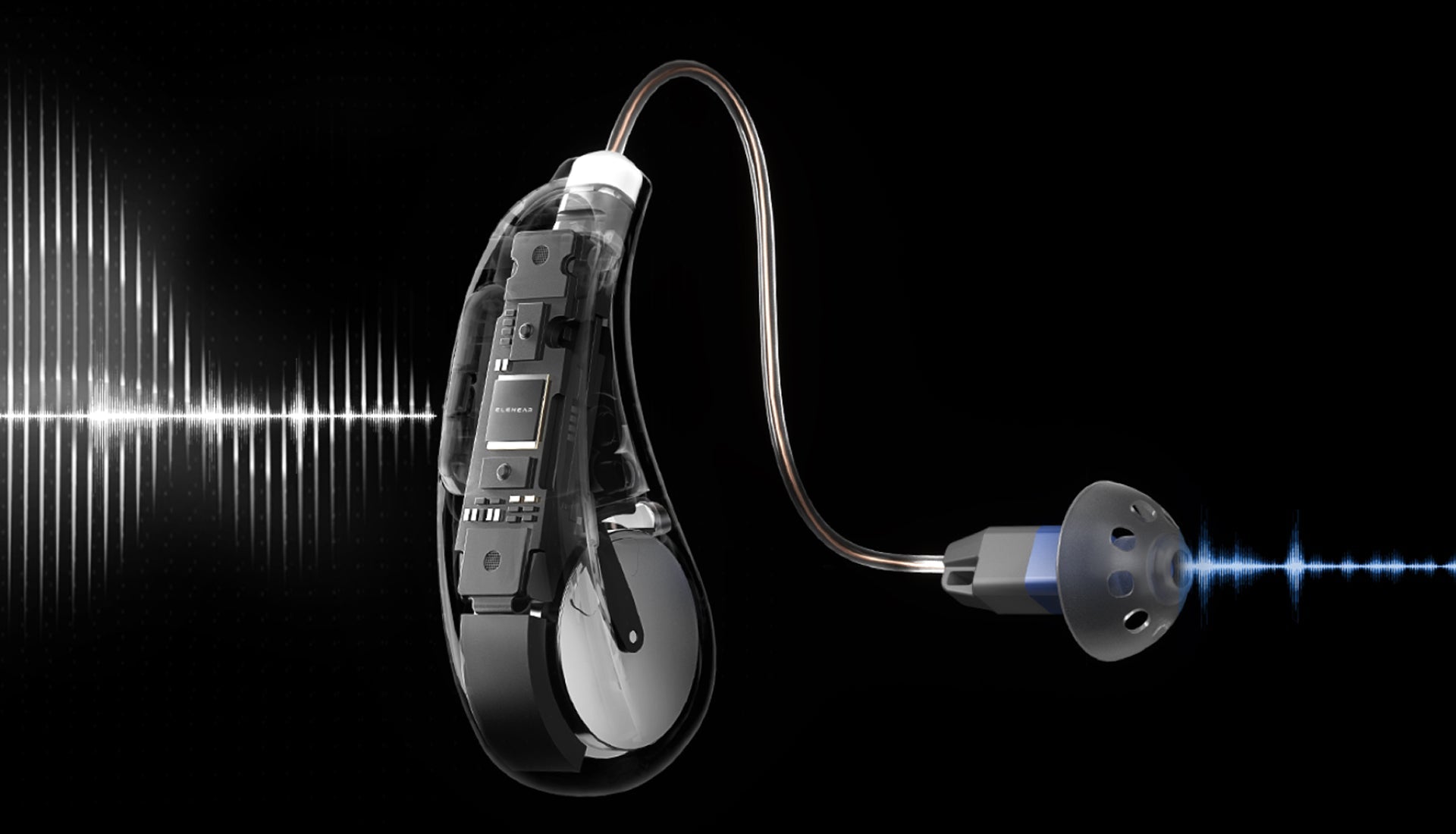 What Is AI Noise Reduction and How Does It Work in Hearing Aids?