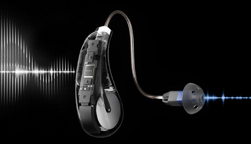 What Is AI Noise Reduction and How Does It Work in Hearing Aids?