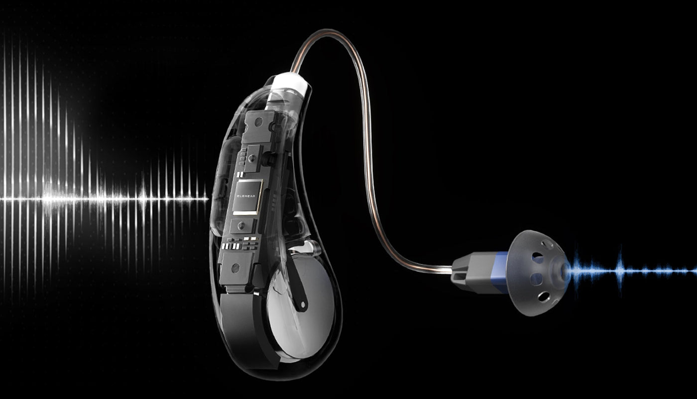 What Is AI Noise Reduction and How Does It Work in Hearing Aids?