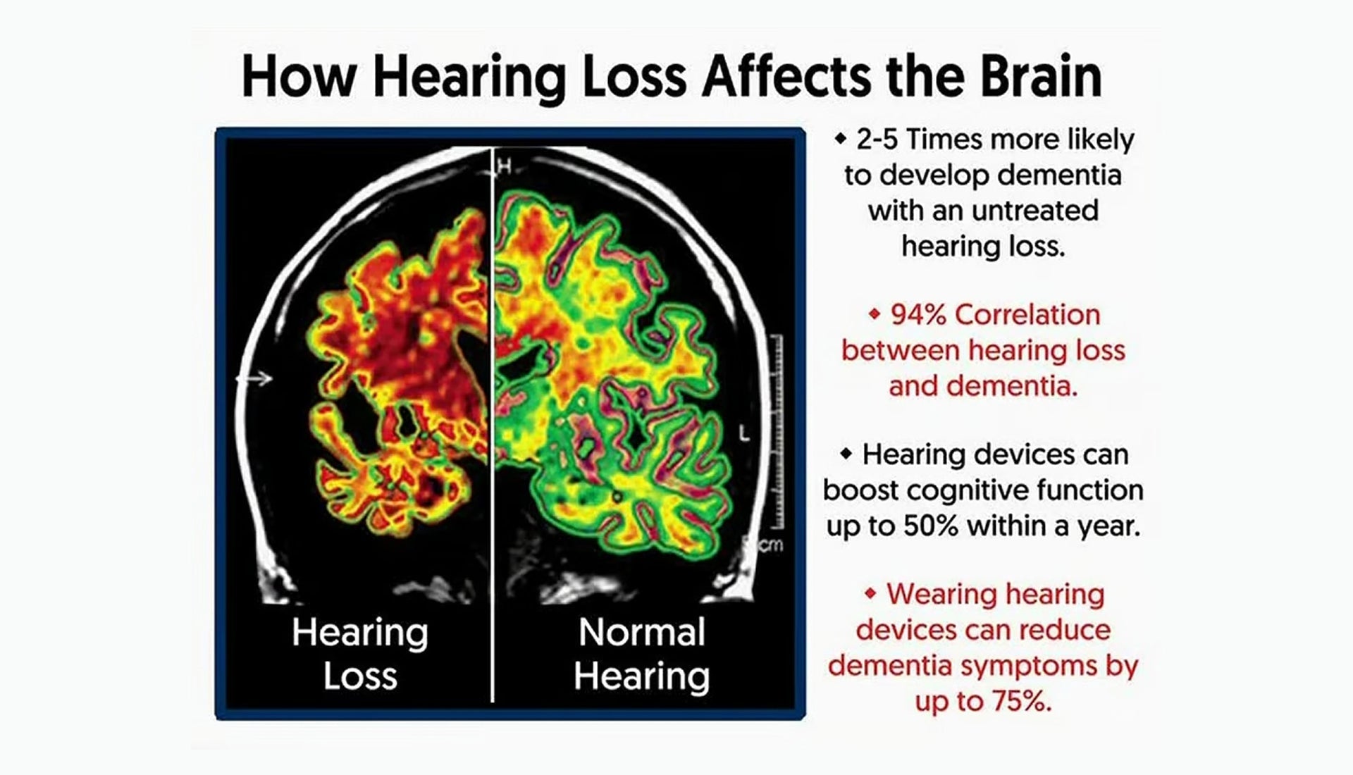 Hearing Loss Is Linked to Dementia — But You Can Act Early