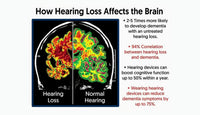 Hearing Loss Is Linked to Dementia — But You Can Act Early