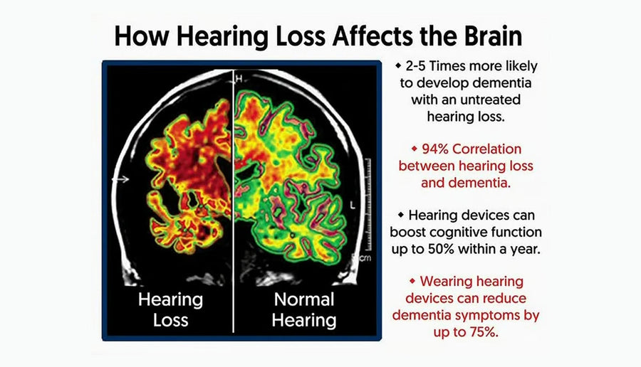 Hearing Loss Is Linked to Dementia — But You Can Act Early
